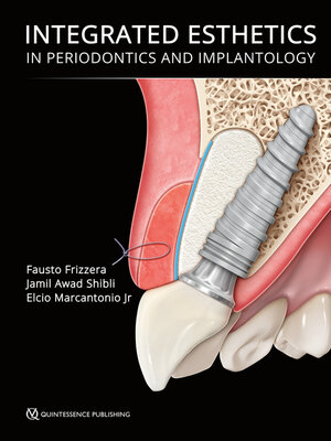 cover image of Integrated Esthetics in Periodontics and Implantology